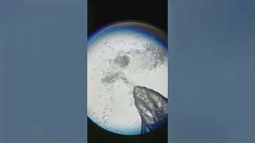 400x  Bresser microscope
